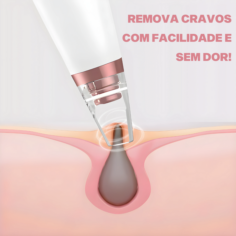 Removedor de Cravos e Espinhas Elétrico - DermaClear®