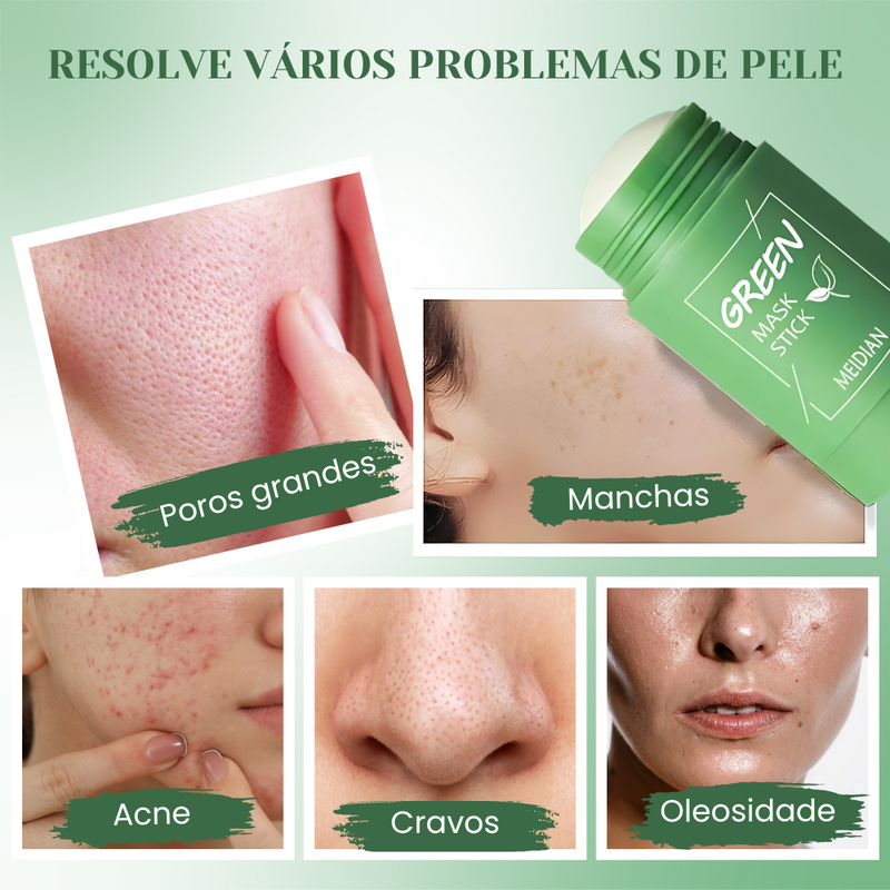 Máscara Facial Green Renew - Diga adeus aos cravos e espinhas!